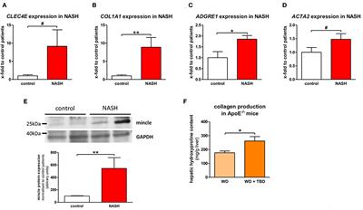 The Role of Macrophage-Inducible C-Type Lectin in Different Stages of Chronic Liver Disease